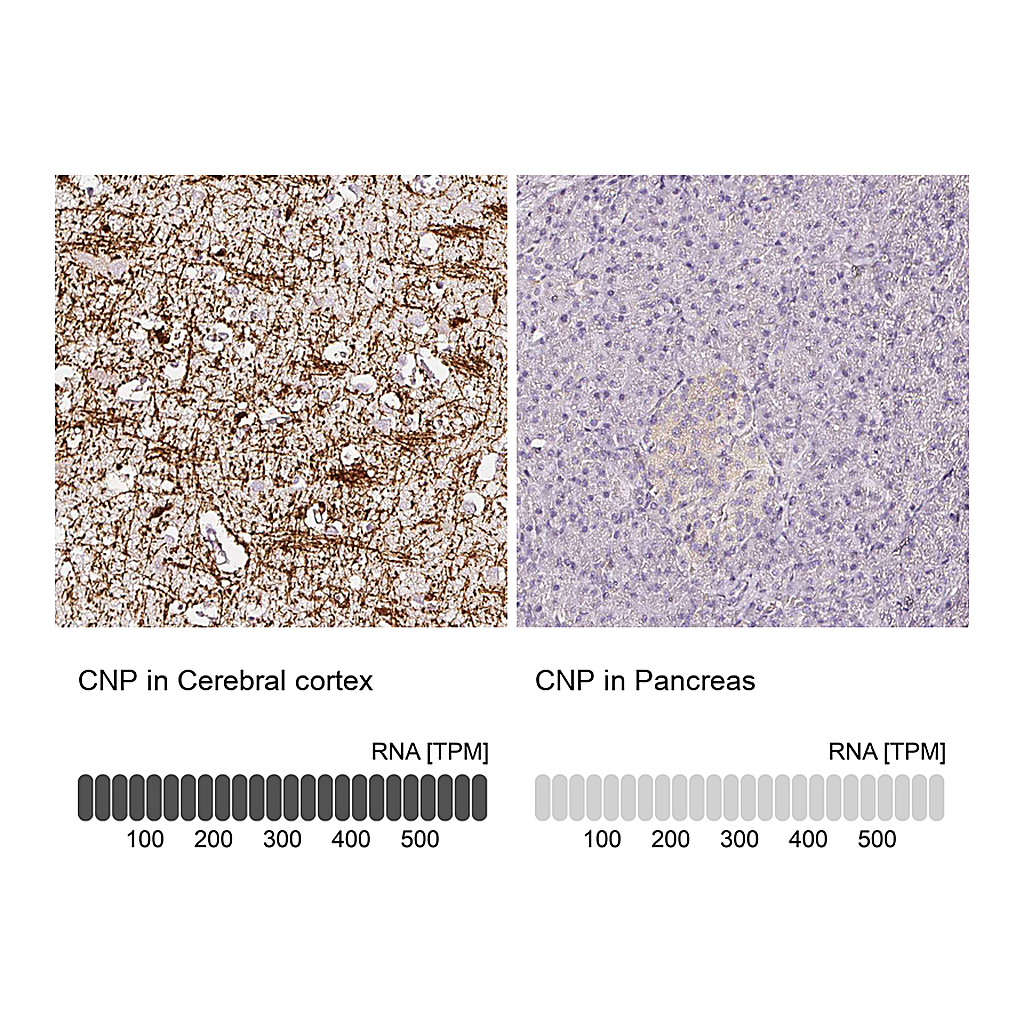 Atlas Antibodies Anti-CNP Antibody