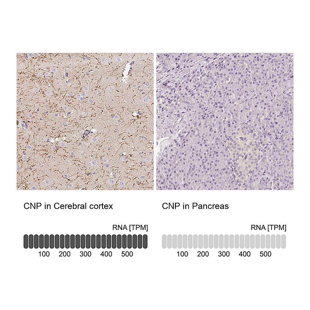 Atlas Antibodies Anti-CNP Antibody
