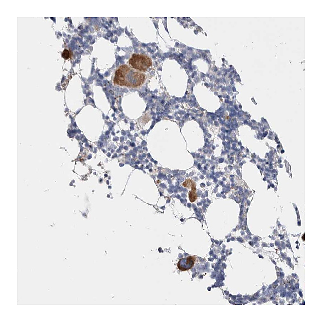 Atlas Antibodies Anti-CNPY4 Antibody
