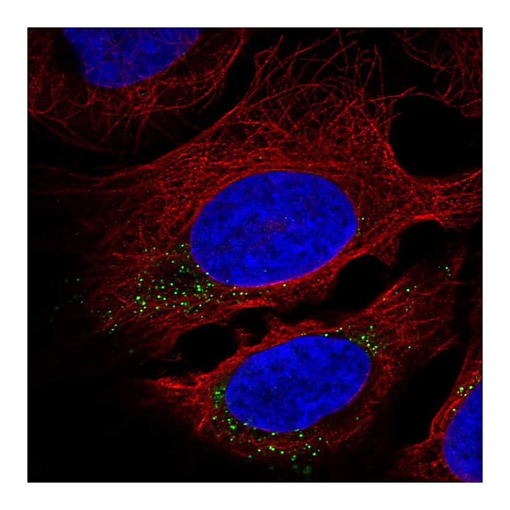 Atlas Antibodies Anti-CNST Antibody