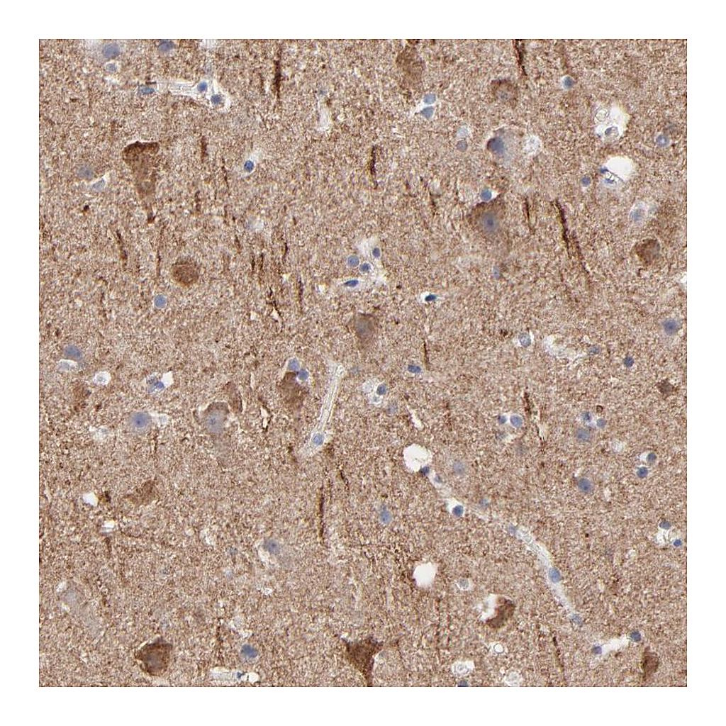 Atlas Antibodies Anti-CNTN3 Antibody