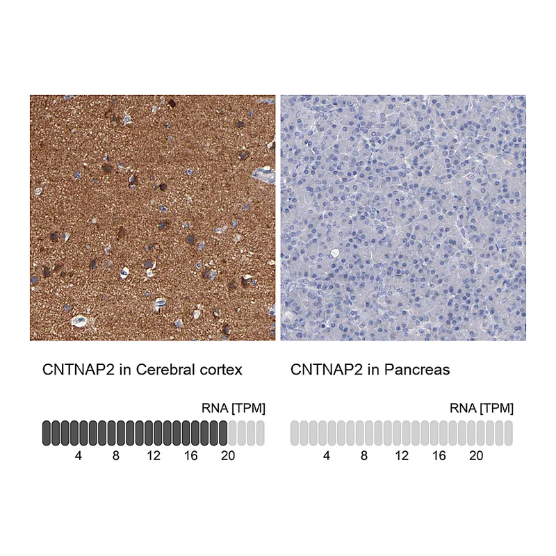 Atlas Antibodies Anti-CNTNAP2 Antibody