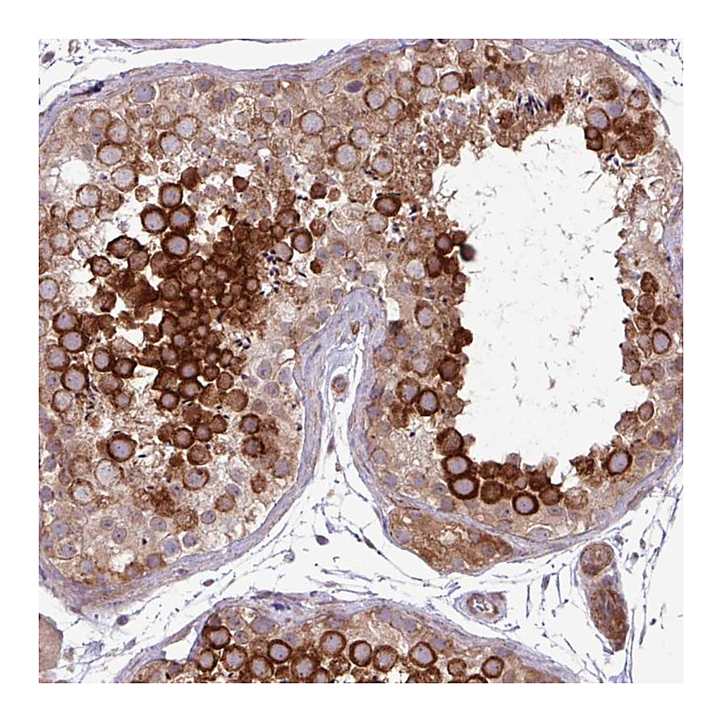 Atlas Antibodies Anti-CNTRL Antibody