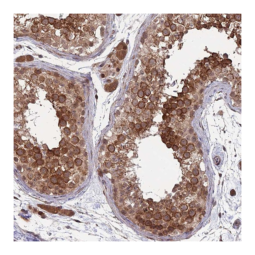 Atlas Antibodies Anti-CNTRL Antibody