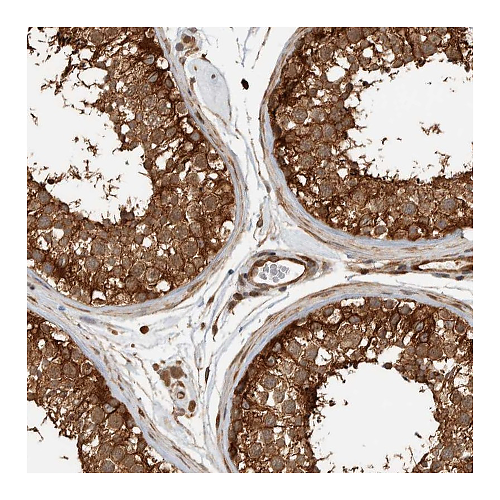 Atlas Antibodies Anti-CNTROB Antibody