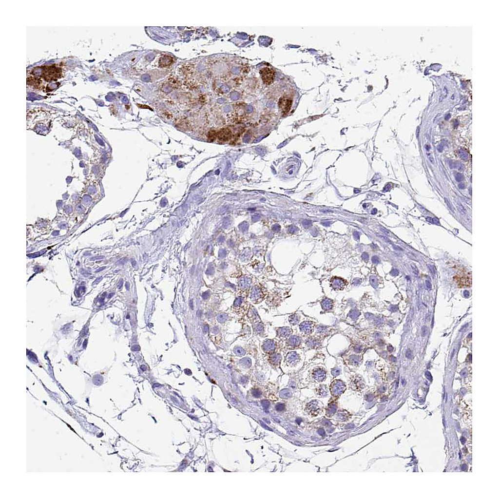 Atlas Antibodies Anti-COA5 Antibody