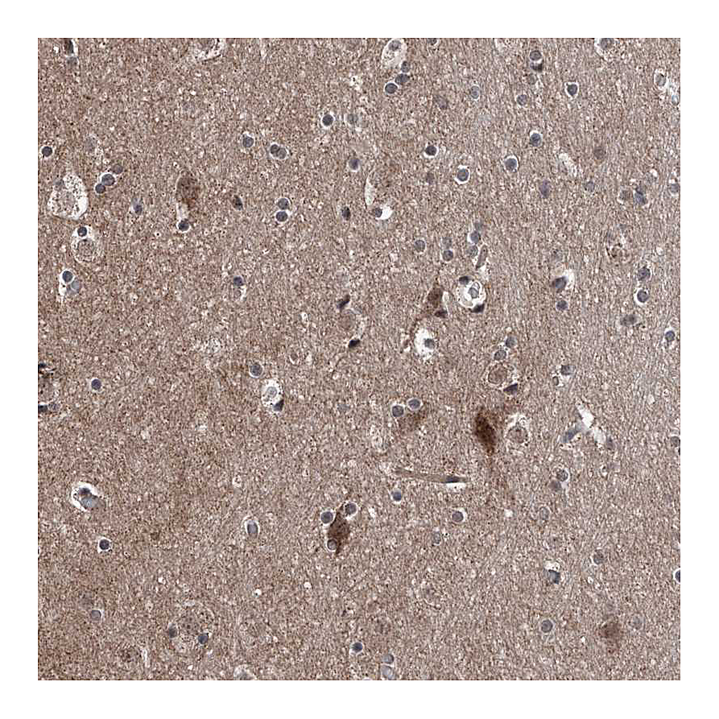 Atlas Antibodies Anti-COA7 Antibody