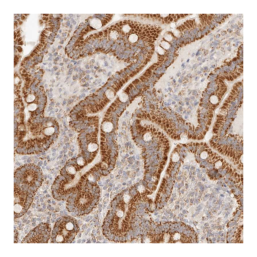 Atlas Antibodies Anti-COA6 Antibody