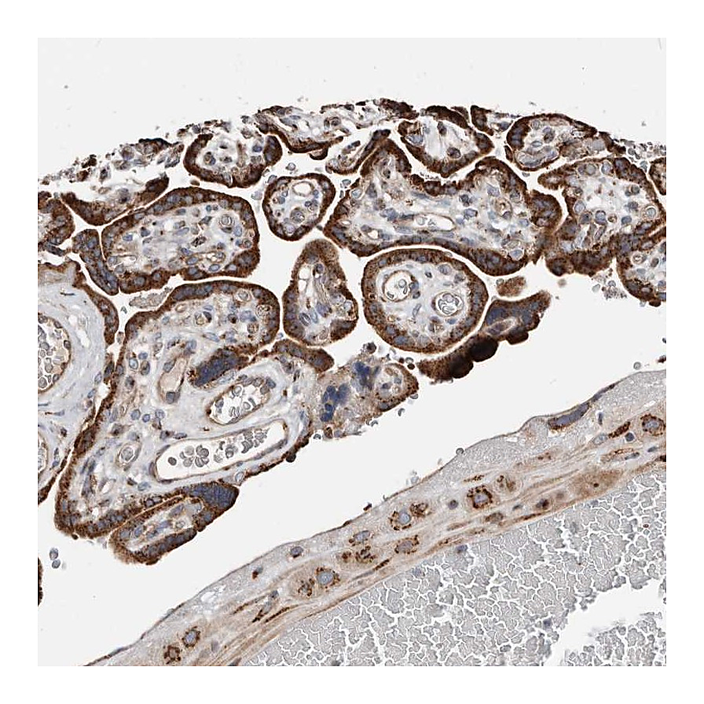Atlas Antibodies Anti-COG1 Antibody