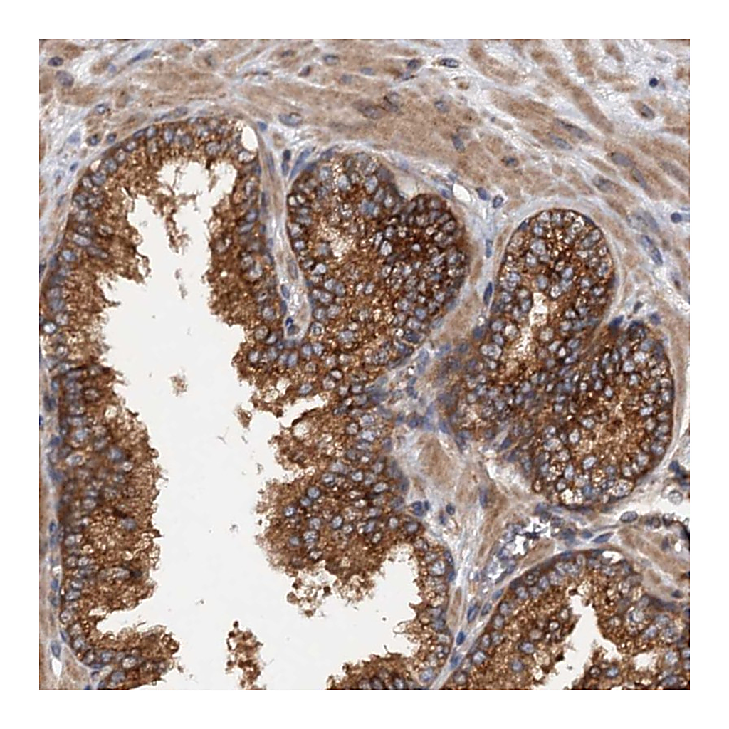 Atlas Antibodies Anti-COG3 Antibody