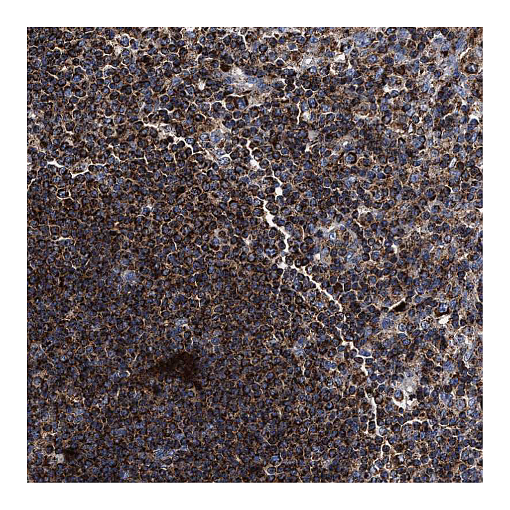 Atlas Antibodies Anti-COG5 Antibody