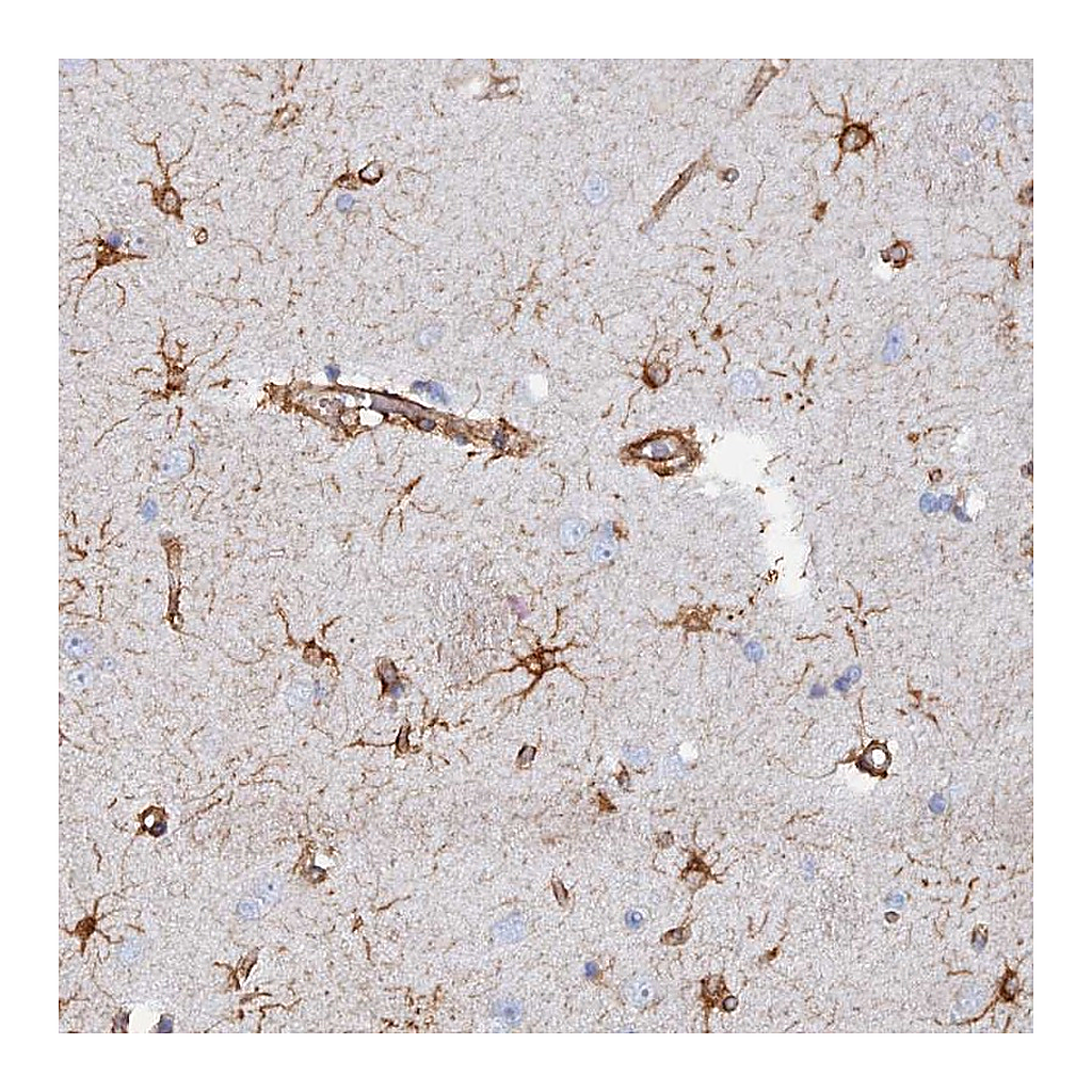 Atlas Antibodies Anti-COG7 Antibody