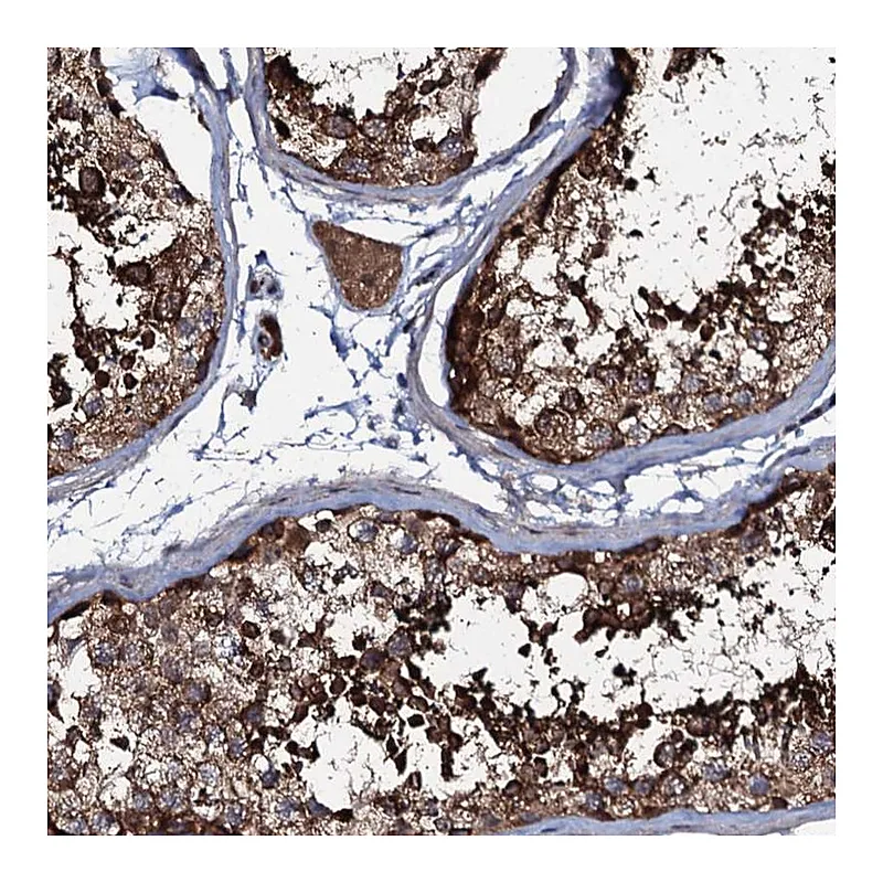 Atlas Antibodies Anti-COG6 Antibody