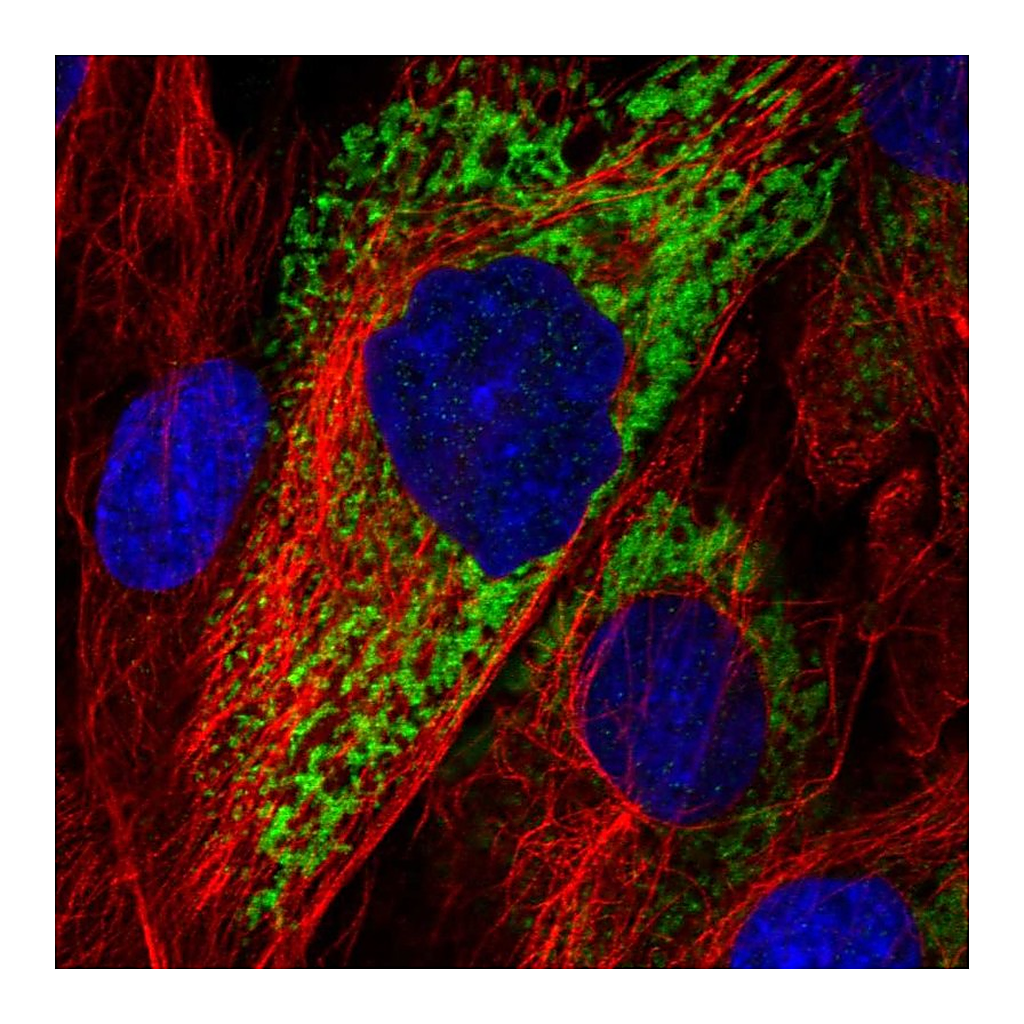 Atlas Antibodies Anti-COL11A1 Antibody