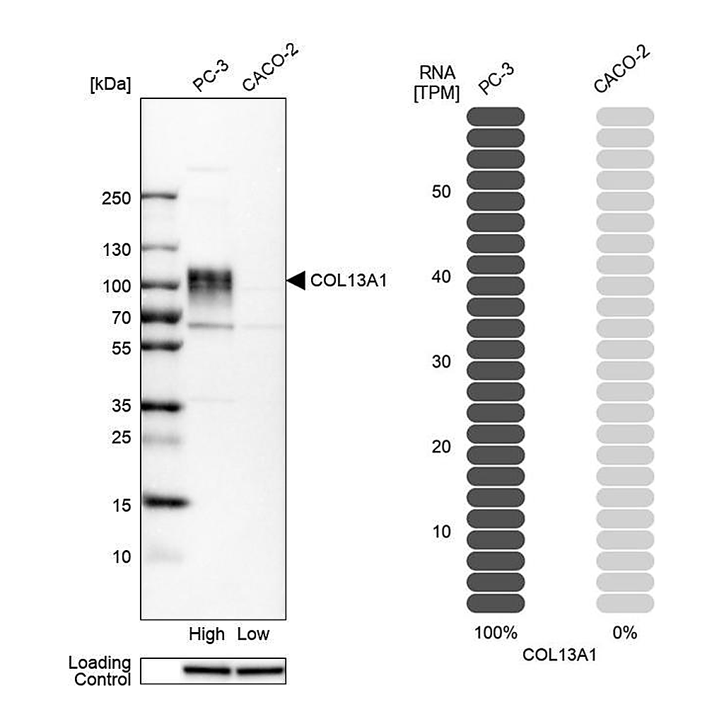 Atlas Antibodies Anti-COL13A1 Antibody