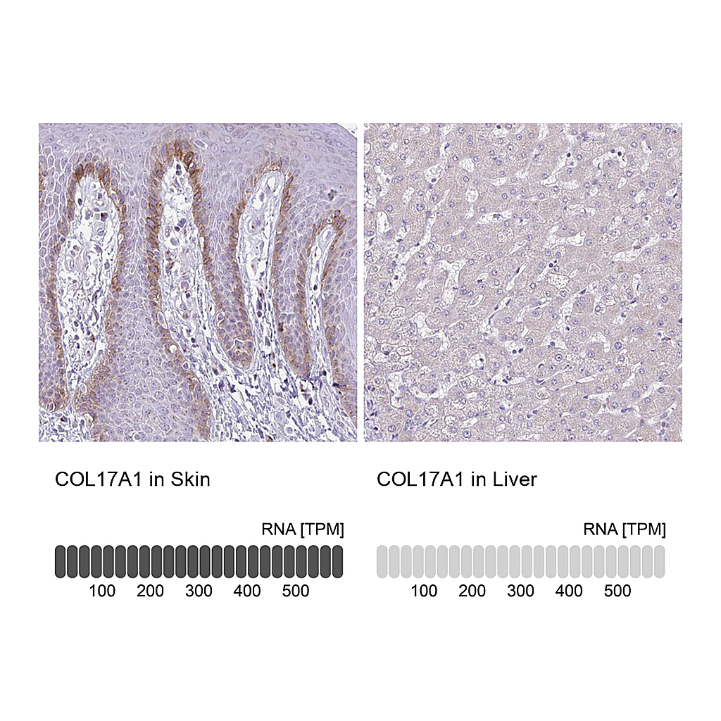 Atlas Antibodies Anti-COL17A1 Antibody