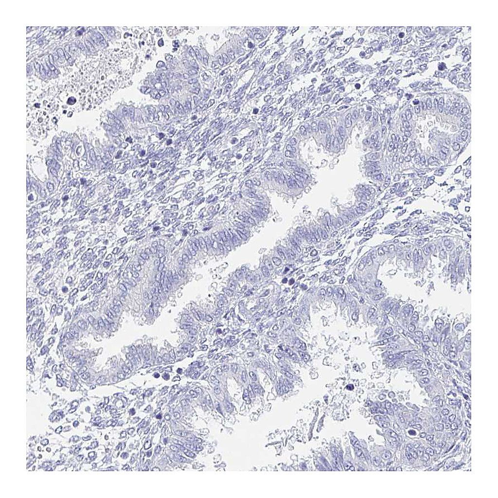 Atlas Antibodies Anti-COL17A1 Antibody