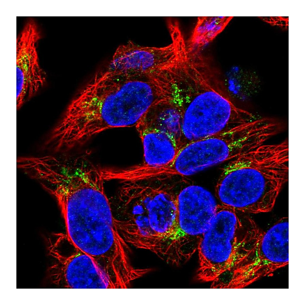 Atlas Antibodies Anti-COL18A1 Antibody