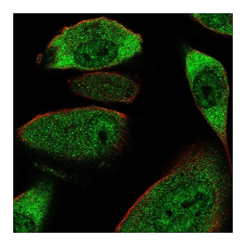 Atlas Antibodies Anti-COL28A1 Antibody