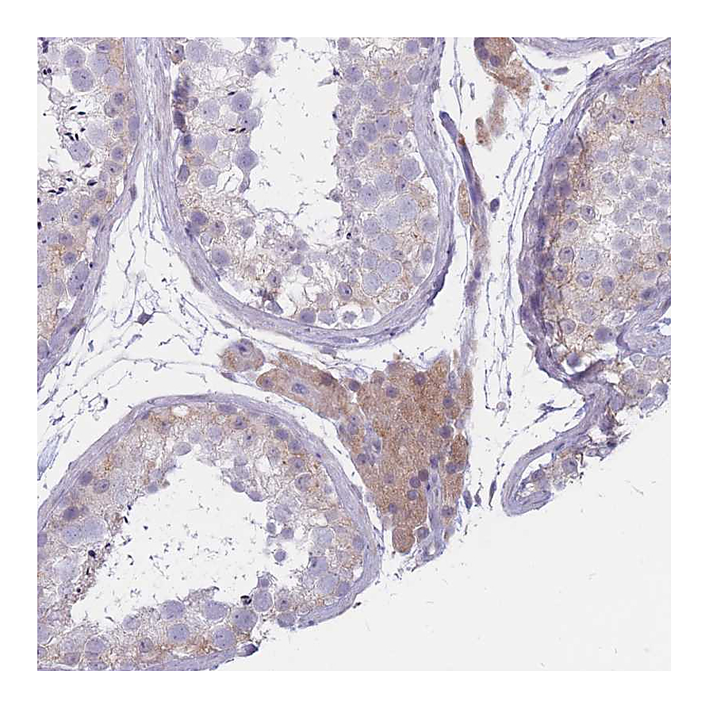Atlas Antibodies Anti-COL27A1 Antibody