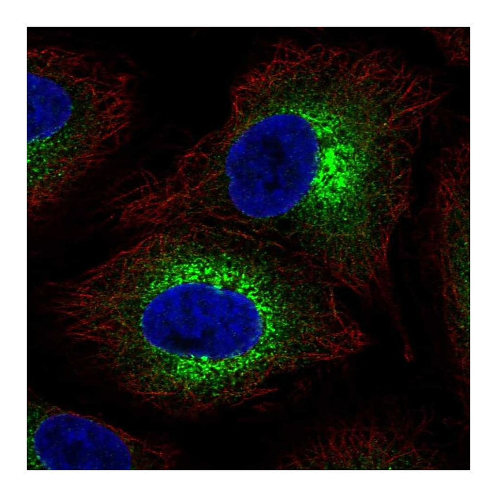 Atlas Antibodies Anti-COL4A6 Antibody
