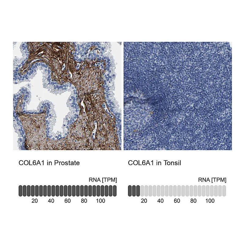 Atlas Antibodies Anti-COL6A1 Antibody