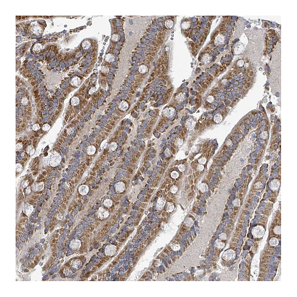 Atlas Antibodies Anti-COL5A3 Antibody