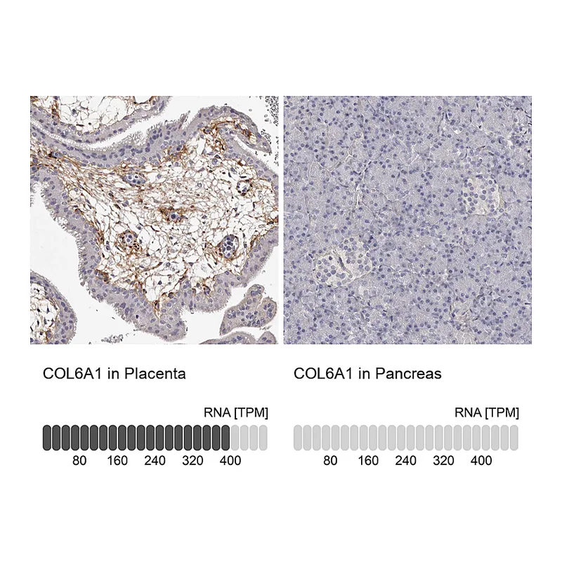 Atlas Antibodies Anti-COL6A1 Antibody