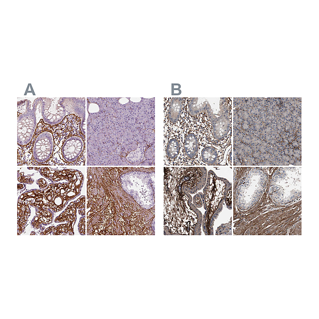 Atlas Antibodies Anti-COL6A2 Antibody