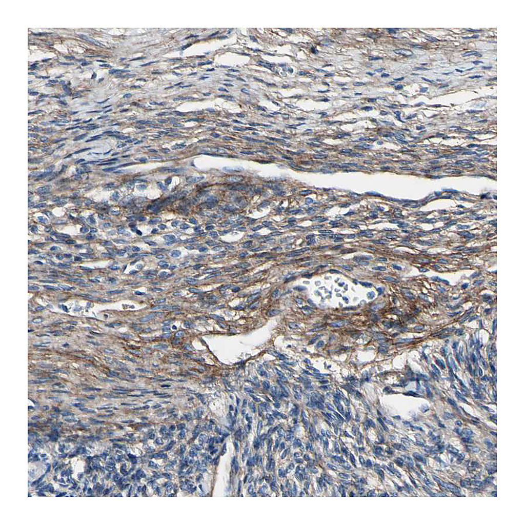 Atlas Antibodies Anti-COL6A3 Antibody