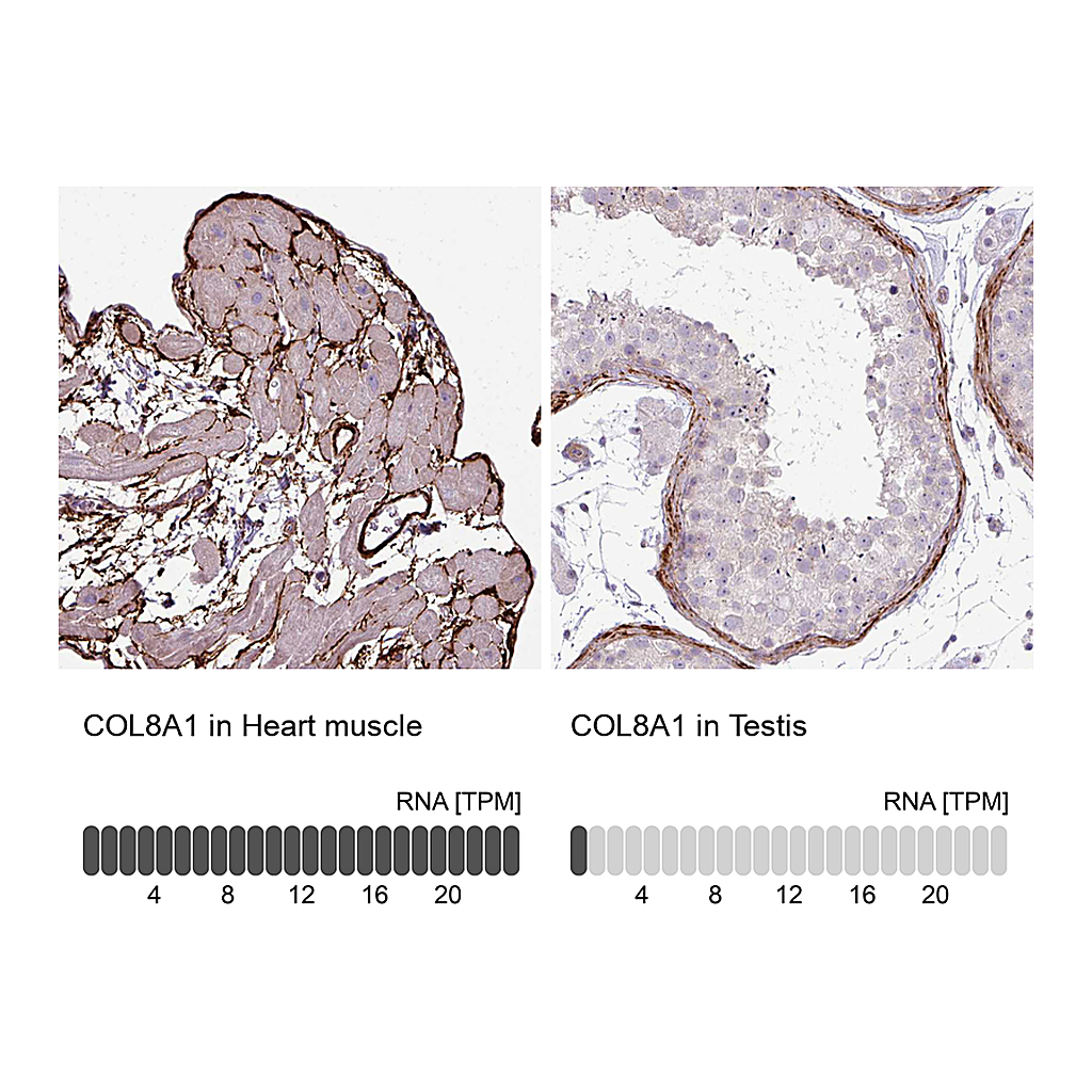 Atlas Antibodies Anti-COL8A1 Antibody