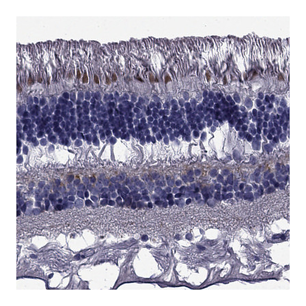 Atlas Antibodies Anti-COL9A1 Antibody