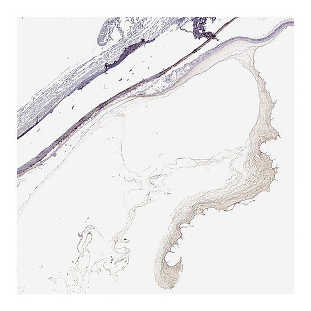 Atlas Antibodies Anti-COL9A3 Antibody