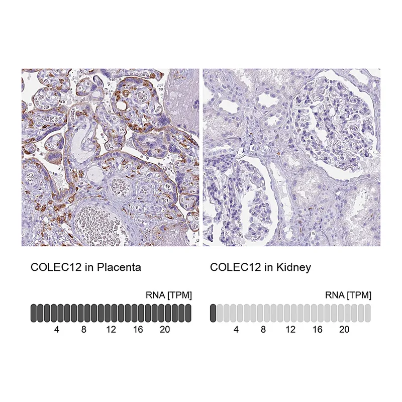 Atlas Antibodies Anti-COLEC12 Antibody