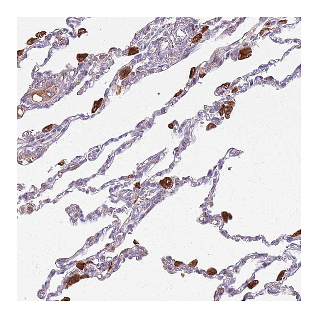 Atlas Antibodies Anti-COLGALT1 Antibody