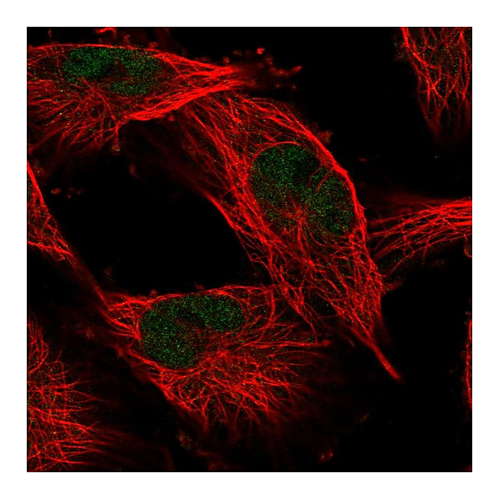 Atlas Antibodies Anti-COMMD1 Antibody
