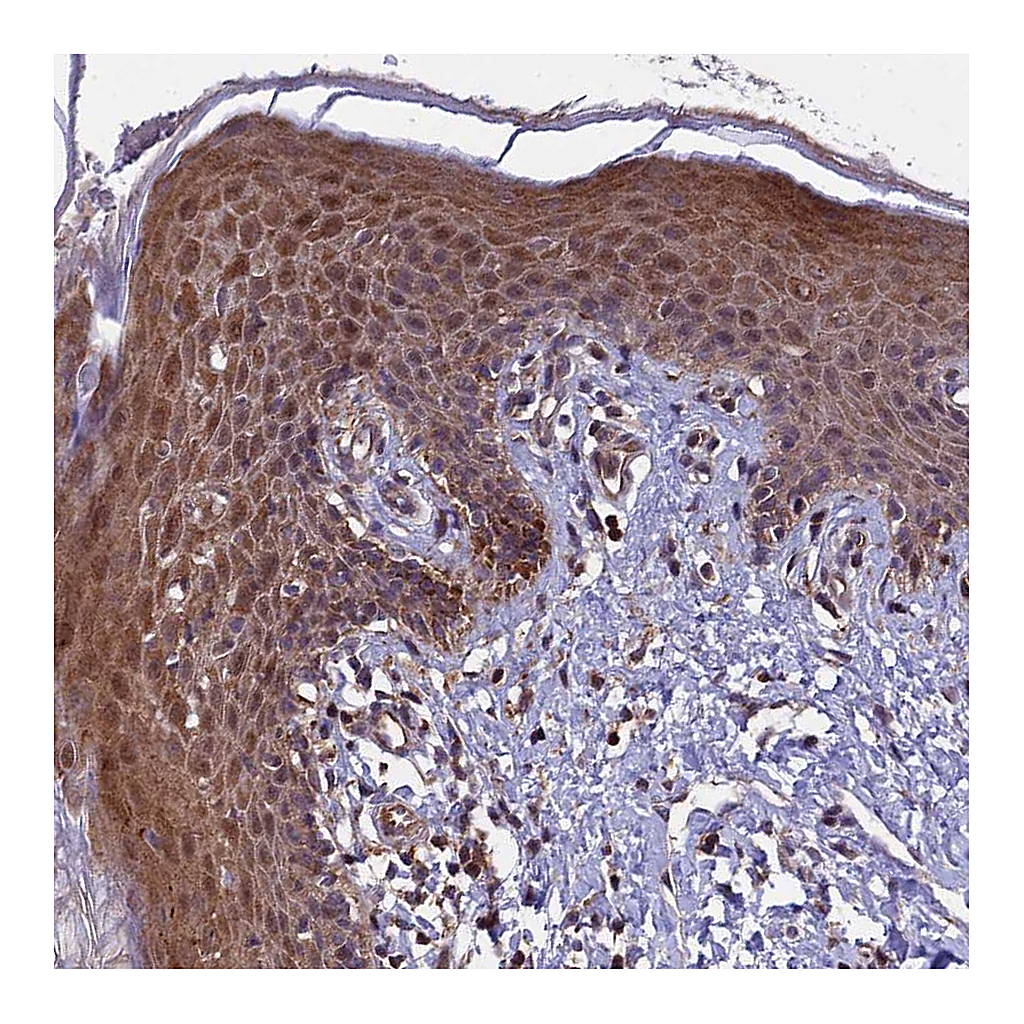Atlas Antibodies Anti-COMMD2 Antibody