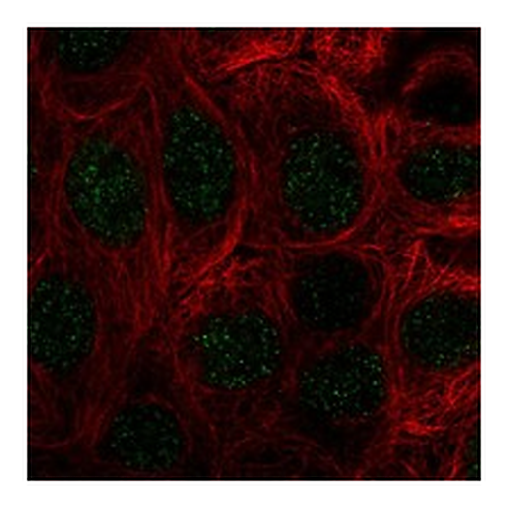 Atlas Antibodies Anti-COMMD10 Antibody
