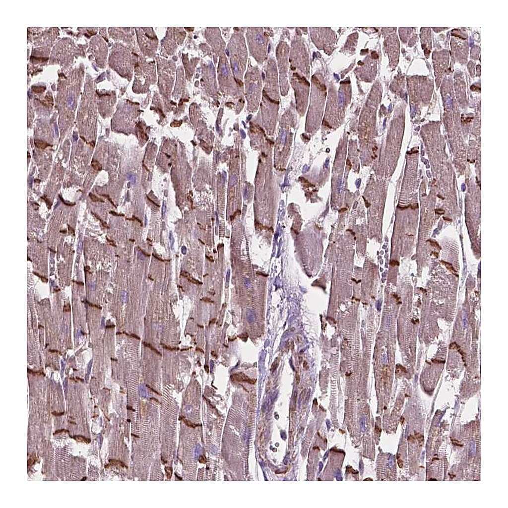 Atlas Antibodies Anti-COMMD4 Antibody