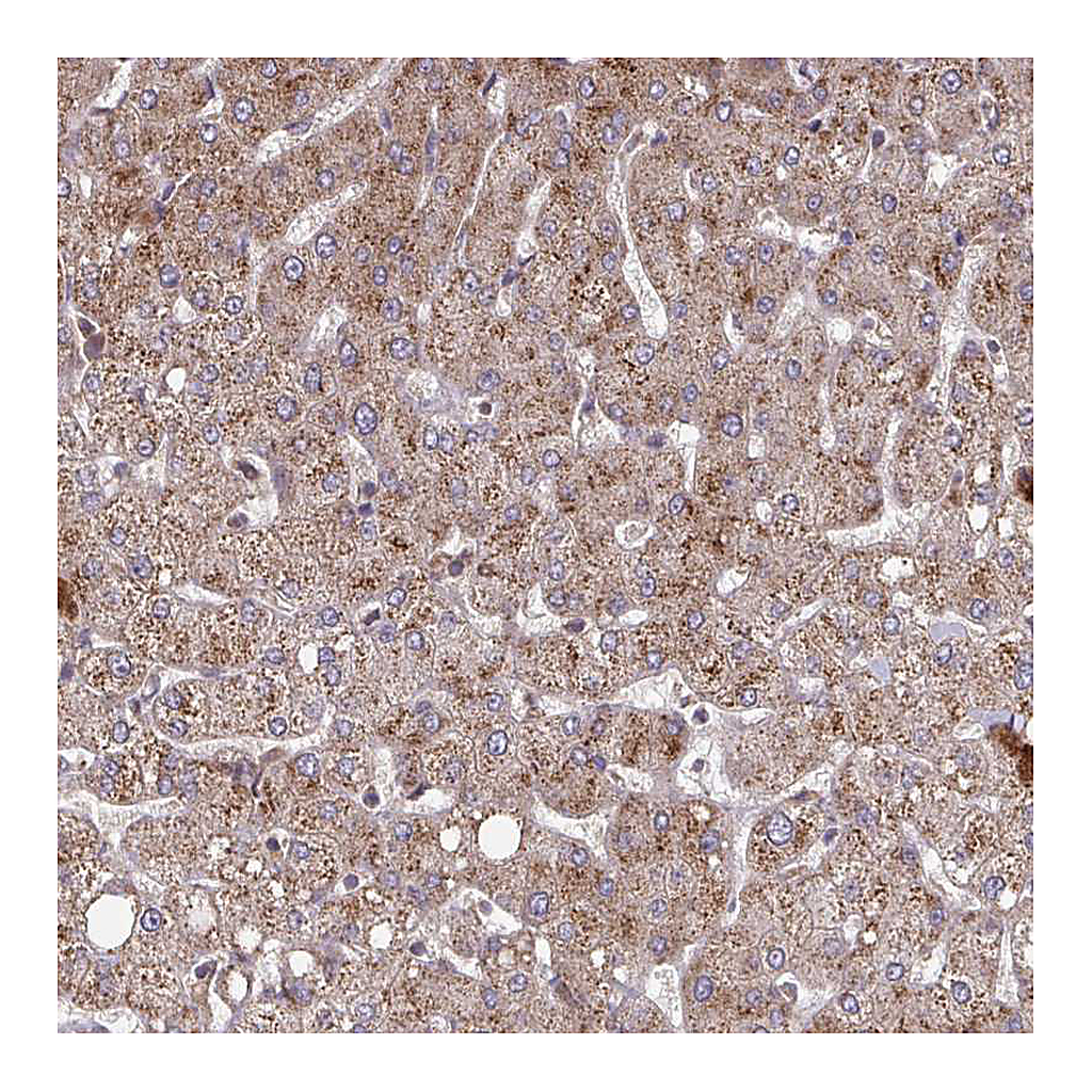 Atlas Antibodies Anti-COPB1 Antibody