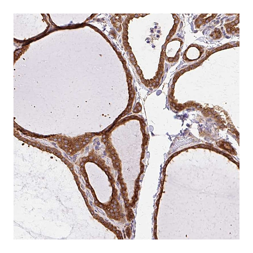 Atlas Antibodies Anti-COPB1 Antibody