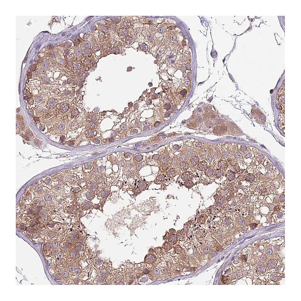 Atlas Antibodies Anti-COPE Antibody