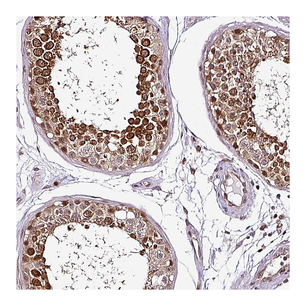 Atlas Antibodies Anti-COPRS Antibody
