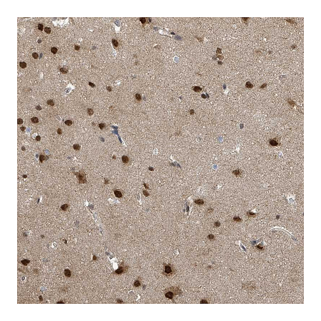 Atlas Antibodies Anti-COQ6 Antibody