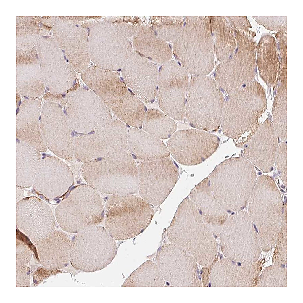 Atlas Antibodies Anti-COQ7 Antibody