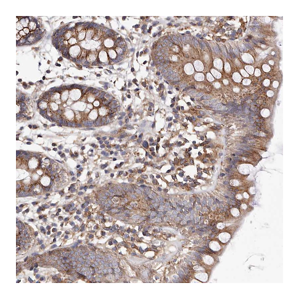 Atlas Antibodies Anti-COQ8B Antibody