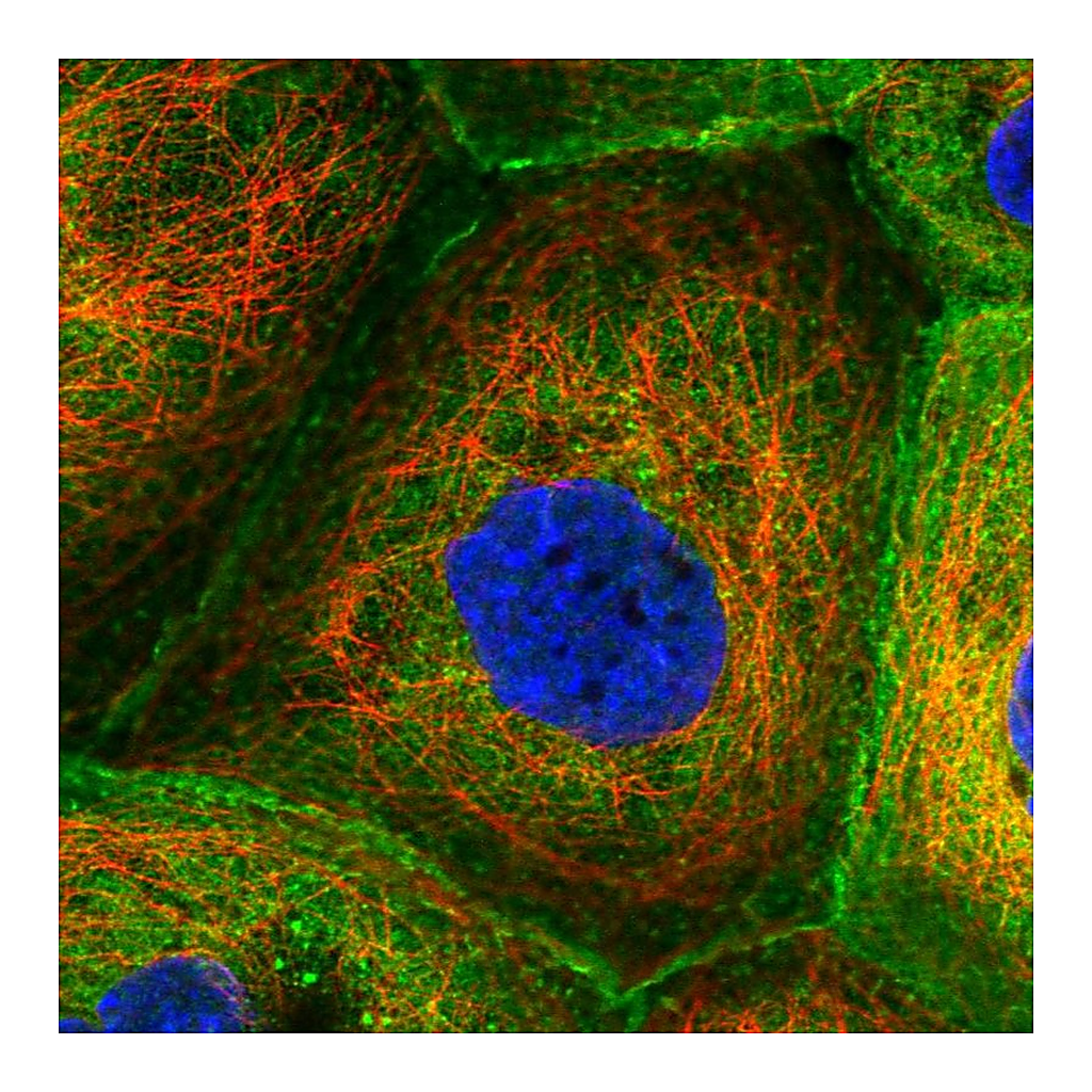Atlas Antibodies Anti-CORO1B Antibody