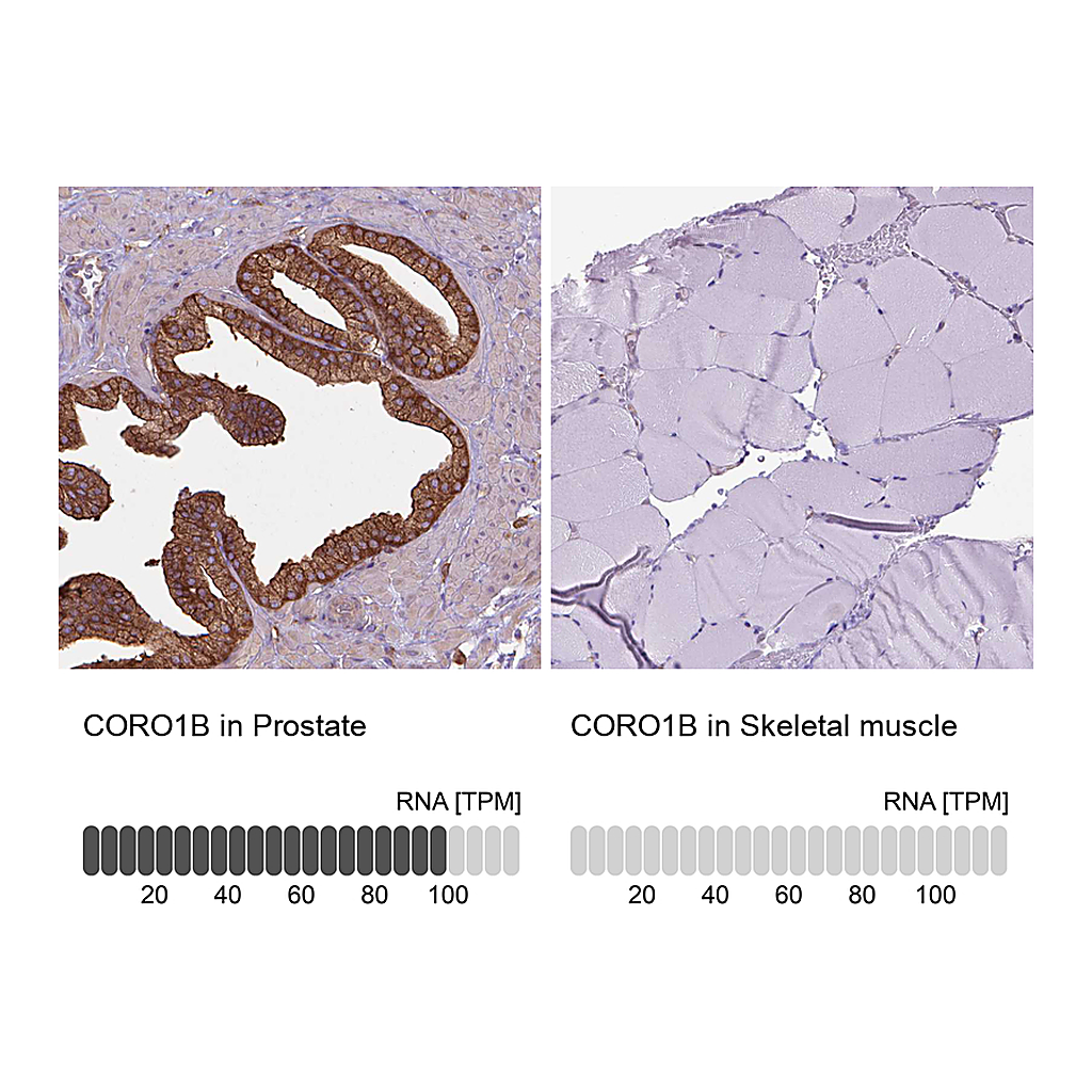 Atlas Antibodies Anti-CORO1B Antibody