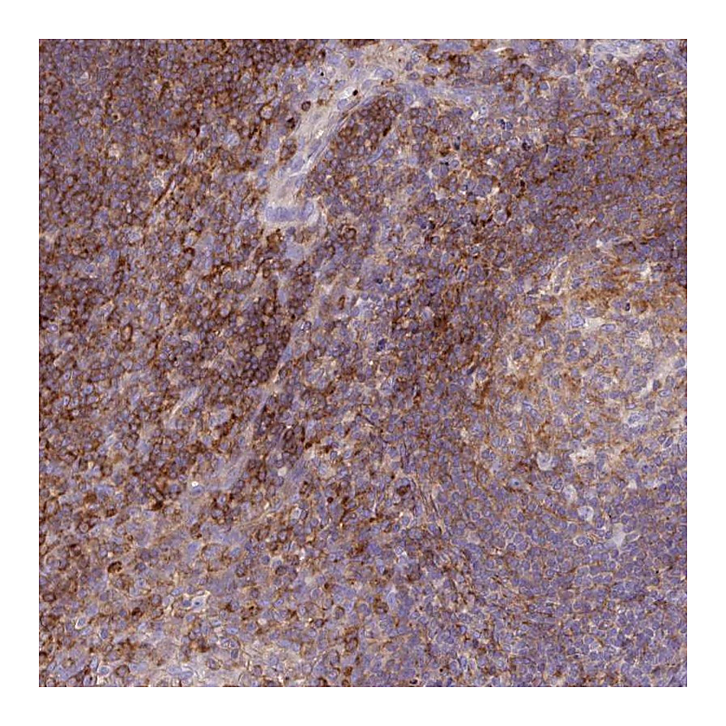 Atlas Antibodies Anti-CORO7 Antibody