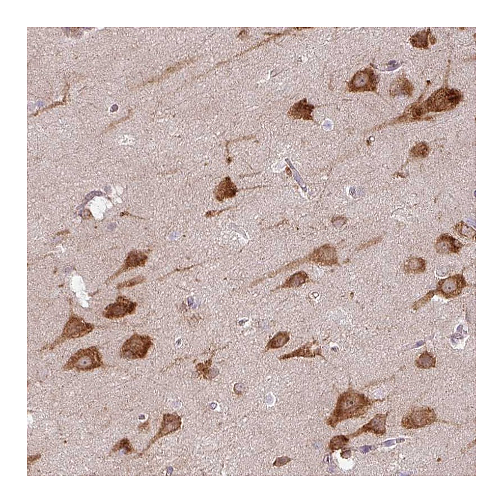 Atlas Antibodies Anti-COX18 Antibody